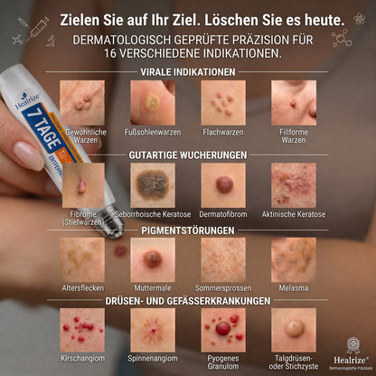 𝐕𝐨𝐧 𝐀𝐩𝐨𝐭𝐡𝐞𝐤𝐞𝐫𝐧 𝐞𝐦𝐩𝐟𝐨𝐡𝐥𝐞𝐧 🥑🥑 𝑯𝗲𝙖𝐥𝒓𝗶𝙯𝗲® 7-Tage Tag & Spot Eraser 🪄 (Rollerball ohne Schmerzen, ohne Narben) 👩‍⚕️